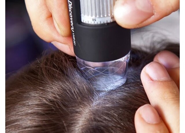 13/11 - Controllo gratuito dei capelli e del cuoio capelluto